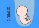培养石家庄捐卵宝宝艺术细胞的小技巧